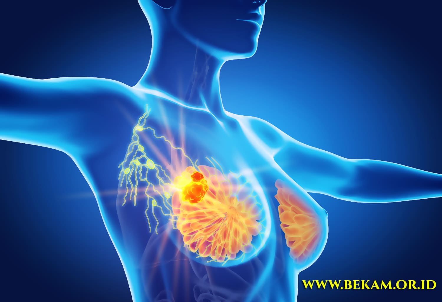 Cupping Therapy Relieves Breast Cancer Pain Here Is the Scientific Explanation and How the Mechanism Works