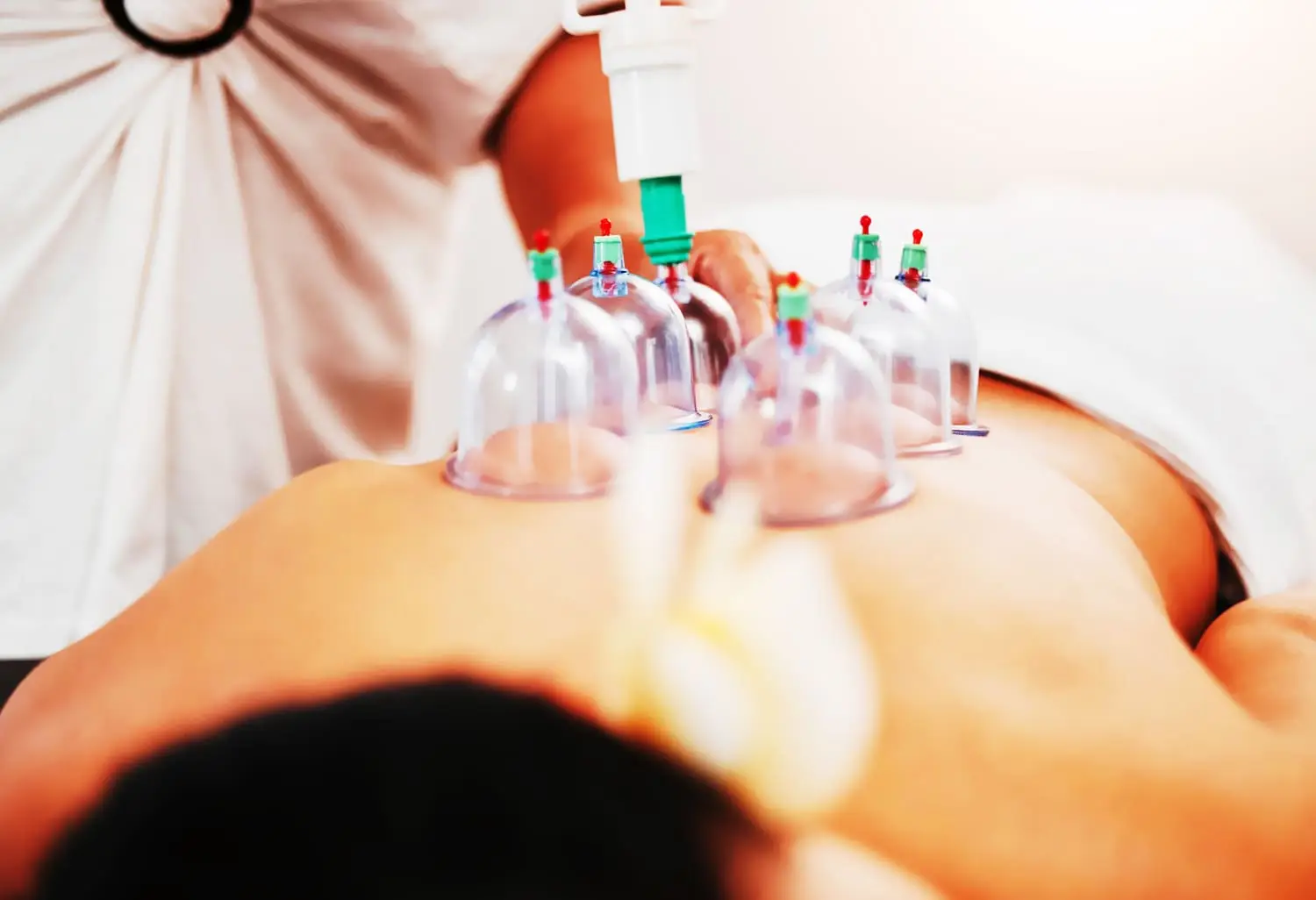 Cupping Therapy as a Supportive Method for Immune and Lymphatic Detoxification